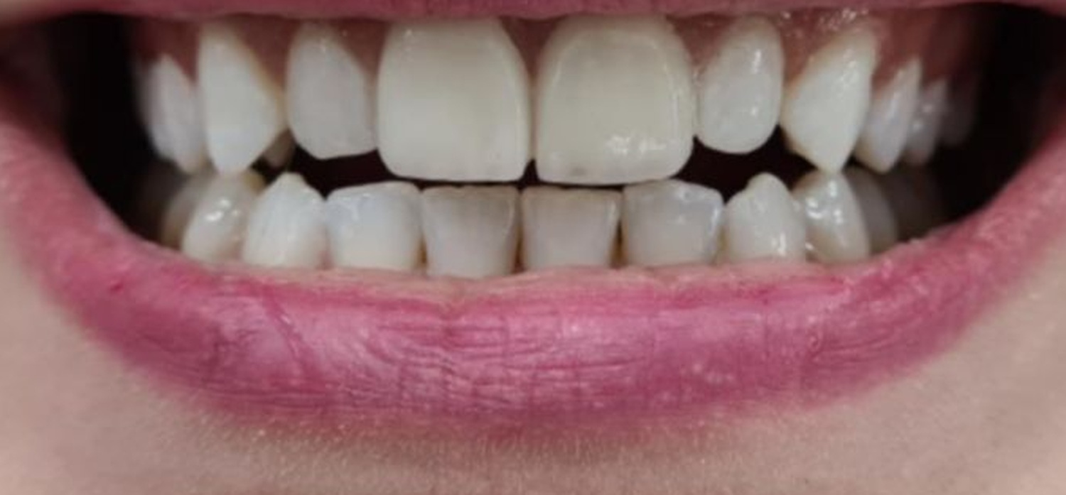 After treatment at İ-Klinik