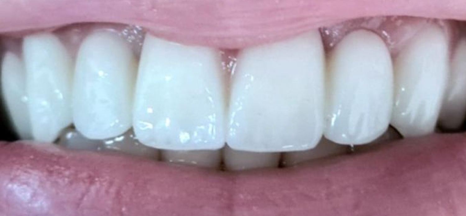 After treatment at İ-Klinik