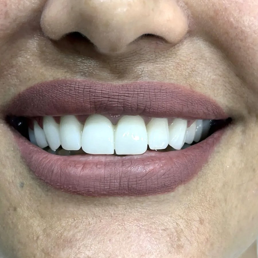 After treatment at İ-Klinik