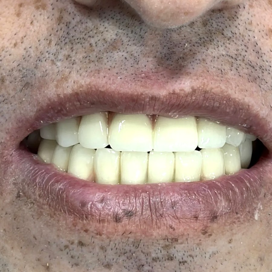 After treatment at İ-Klinik