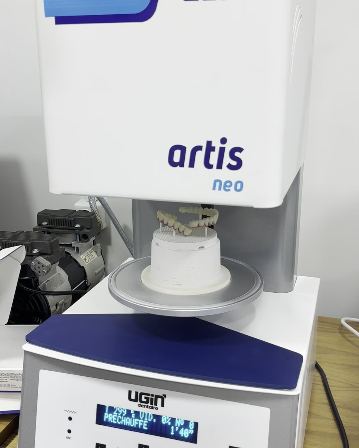 UGIN artis neo porcelain furnace with a full-arch restoration